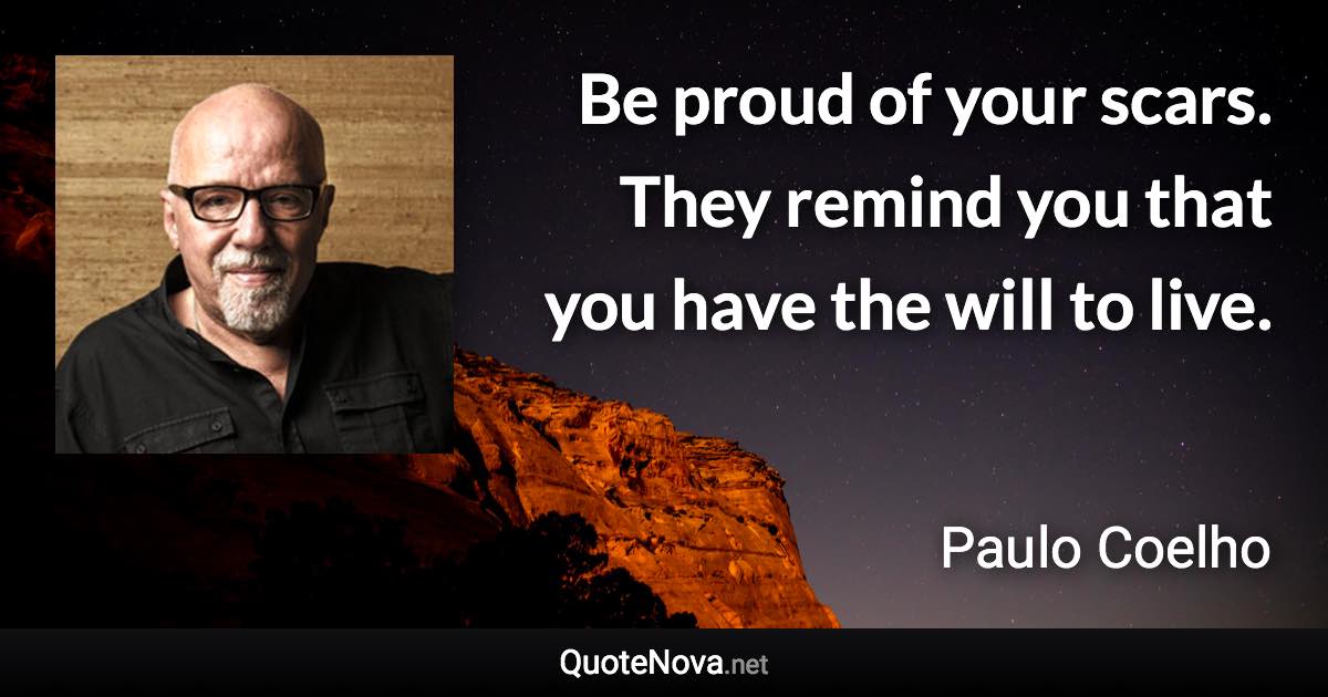 Be proud of your scars. They remind you that you have the will to live. - Paulo Coelho quote